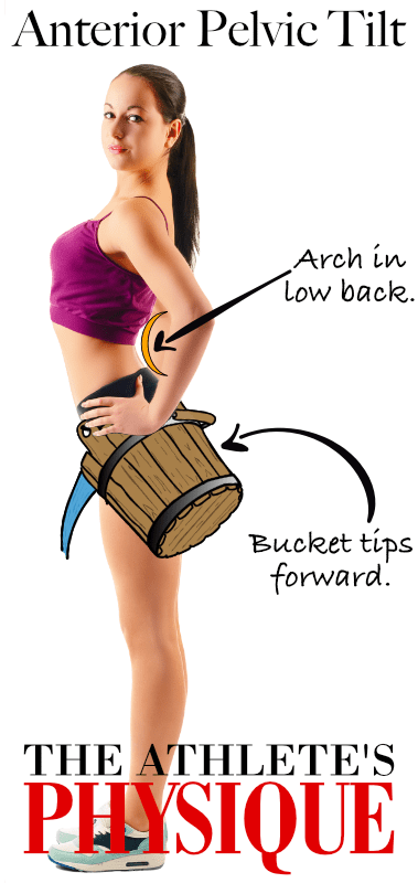 Anterior Pelvic Tilt